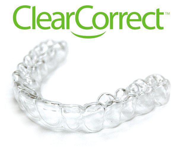 Clear Correct Braces Fort Collins Dentist